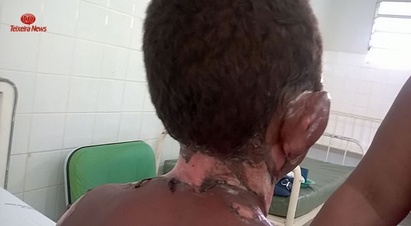 (Foto: Reprodução / Teixeira News)