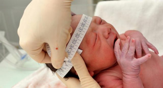 A doença é caracterizada por uma malformação cerebral. Foto: brasil.babycenter.com.