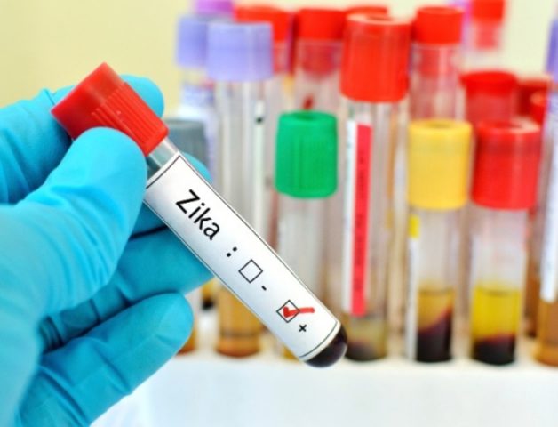 Os procedimentos deverão ser disponibilizados para gestantes, bebês filhos de mães com diagnóstico de infecção pelo vírus, bem como aos recém-nascidos com má formação congênita (Imagem Ilustrativa)