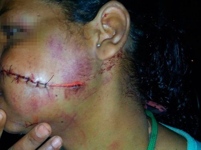 O rapaz foi liberado porque não houve denúncia por parte da vítima, mas que, mesmo assim, o suspeito vai responder pelo crime com base na Lei Maria da Penha (Foto: Reprodução / Edivaldo Braga/ Blog Braga)