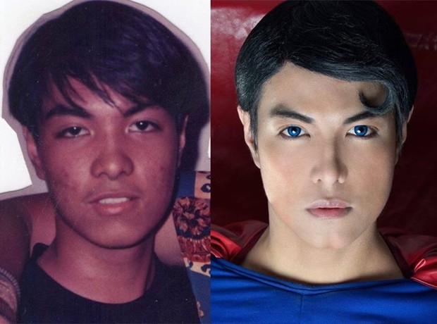 Antes e depois: o filipino Herbert Chavez, de 37 anos, fez 23 plásticas para ficar parecido com o Super-Homem (Foto: Facebook / Reprodução)