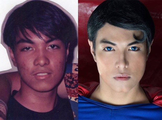 Antes e depois: o filipino Herbert Chavez, de 37 anos, fez 23 plásticas para ficar parecido com o Super-Homem (Foto: Facebook / Reprodução)