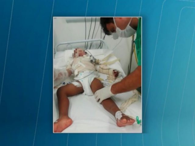 Jeanderson de Jesus Casais está internado no Hospital Estadual da Criança, em Feira de Santana. Foto: Reprodução/TV Subaé)