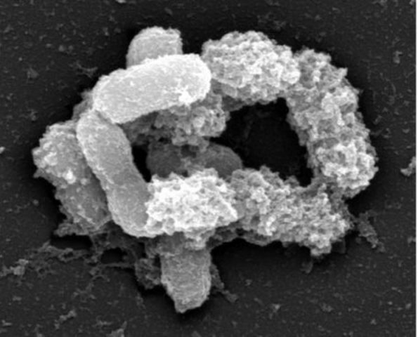 A bactéria Akkermansia muciniphila. Proteína faz parte da membrana externa da bactéria (Foto: Reprodução/BBC Brasil)