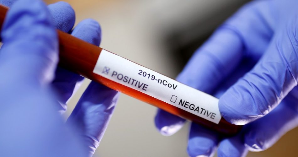 Foto ilustrativa mostra adesivo com resultado positivo para o novo coronavírus — Foto: Dado Ruvic/Reuters/Arquivo
