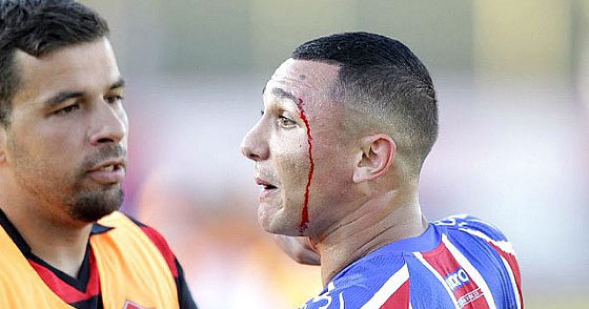 Atleta deixou o campo sangrando após ser agredido. Foto: Arisson Marinho.
