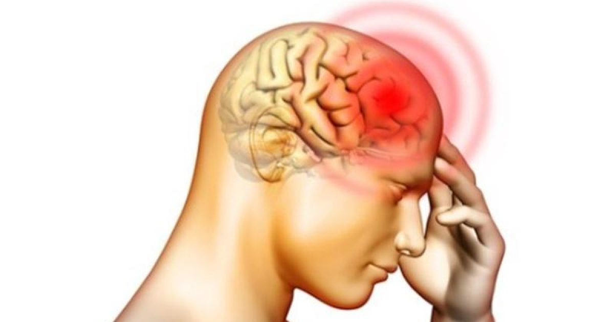 Meningite é uma inflamação das meninges, que são as membranas que envolvem o cérebro e a medula espinhal. Imagem: radiosolaris.com.br.
