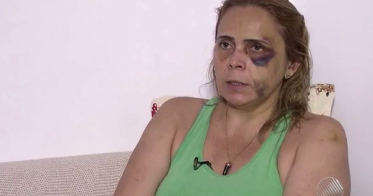 Alexandra do Nascimento denunciou que sofreu agressões do ex-namorado, o humorista Renato Fechine (Foto: Reprodução/TV Bahia)