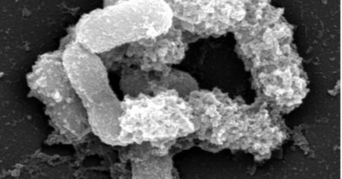 A bactéria Akkermansia muciniphila. Proteína faz parte da membrana externa da bactéria (Foto: Reprodução/BBC Brasil)
