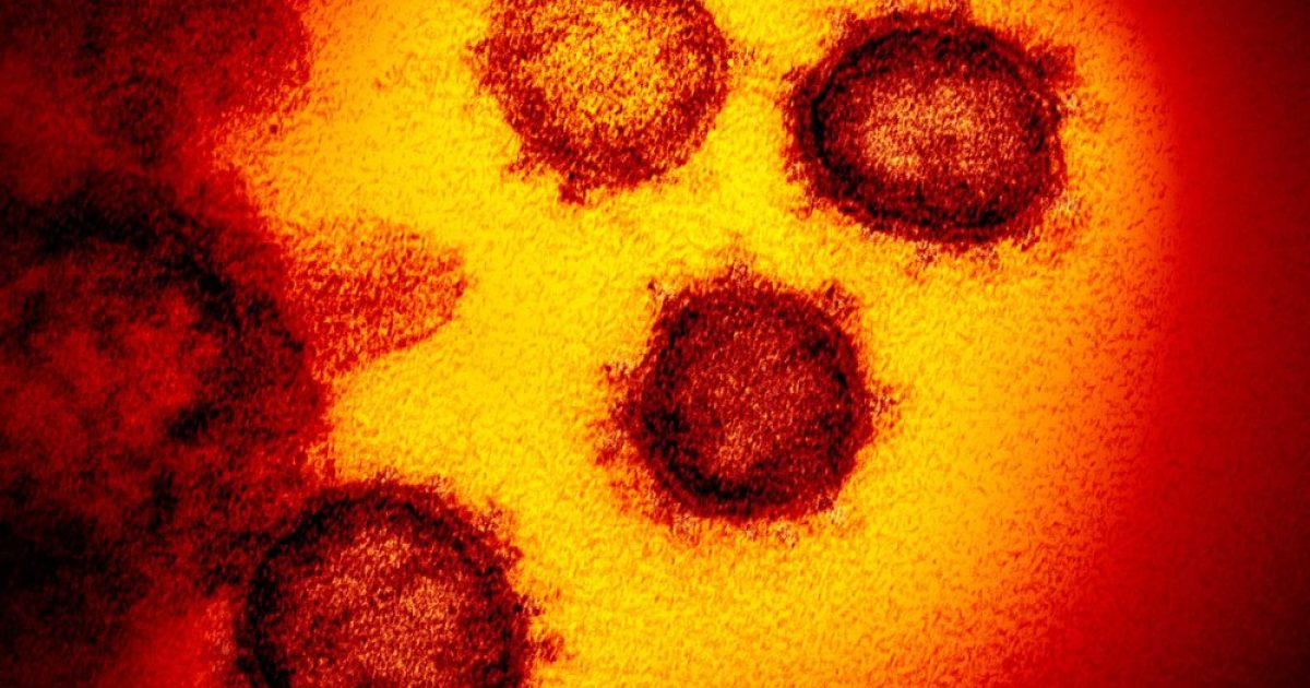 Imagem de microscópico mostra o novo coronavírus, responsável pela doença chamada Covid-19 — Foto: NIAID-RML/AP