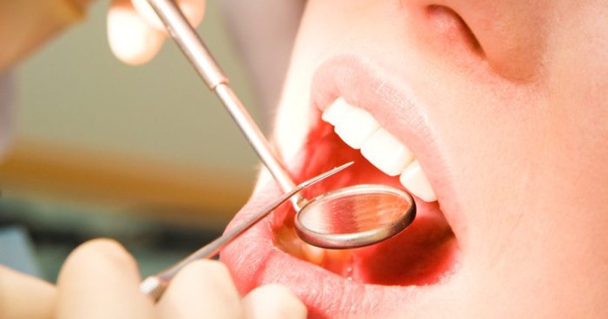 Aspirina pode regenerar dente após cárie, dizem cientistas (Foto: Reprodução)