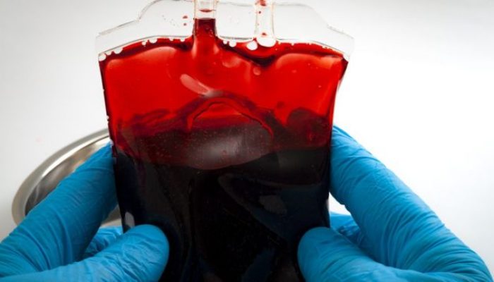 Só são conhecidas cerca de 40 pessoas que possuem o Rh nulo. Esse raro tipo sanguíneo pode salvar vidas, mas também representa grandes riscos a quem é portador (Foto: Getty Images)