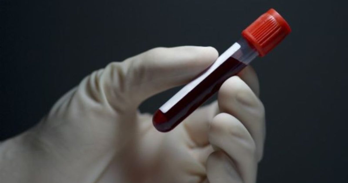Novo exame pode facilitar diagnóstico de doenças cardíacas hereditárias. Foto: Reprodução/BBC Brasil