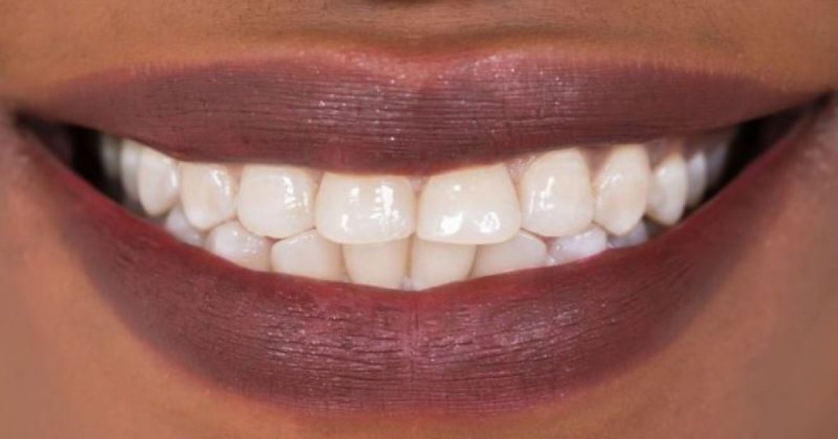 Nova droga estimularia regeneração extra dos dentes (Foto: Thinkstock)