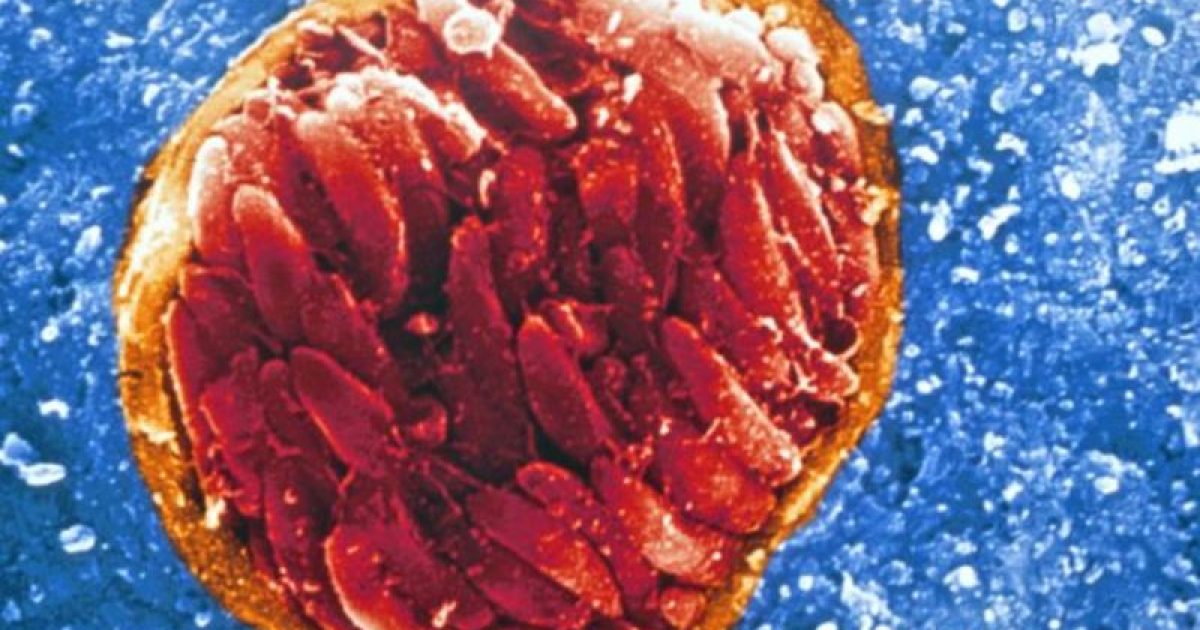 Toxoplasma gondii é um protozoário comum, que se reproduz em gatos e se espalha em suas fezes, e causa a toxoplasmose. (Foto: Reprodução/BBC Brasil)