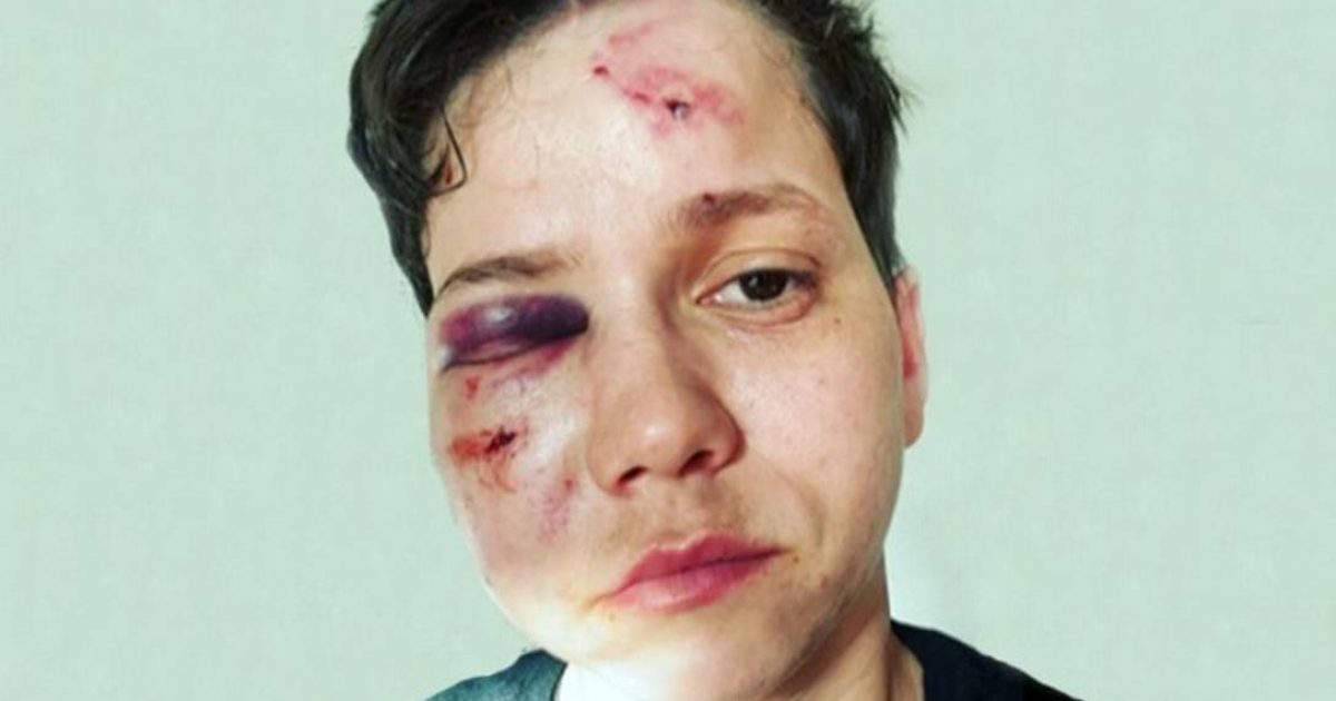 Youtuber Karol Eller foi agredida no Rio de Janeiro Foto: Reprodução